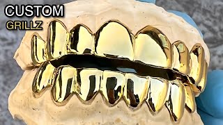 Custom Grillz 8 On 8 Teeth Gold Plated over 925 Silver Grills [upl. by Enixam779]