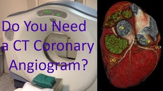 Do you need a CT coronary angiogram [upl. by Aekal253]