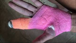 Astros fan says tshirt cannon shattered her finger [upl. by Renferd]