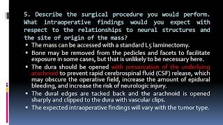 127 Intradural Spinal Tumor [upl. by Zima]