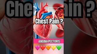 Angina in Tamil  Chest Pain in Tamil  heartattack [upl. by Olin]