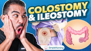 Colostomy and Ileostomy Nursing  Indications Complications Care EASY [upl. by Airdnaid]