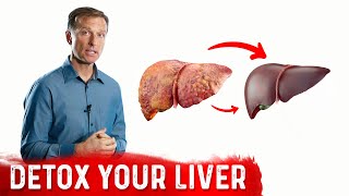 A Surprising Way To Cleanse Fatty Liver – Dr Berg On Liver Detoxification [upl. by Kellby530]