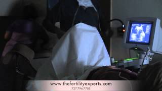 IVF Embryo Transfer [upl. by Faydra]