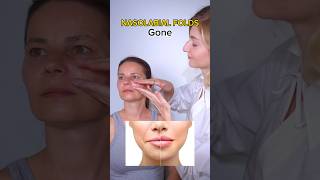 nasolabial folds gone smilelines faceyogaexercises facialyoga facialfitness facemassage [upl. by Honeywell65]