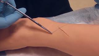 Simple Interrupted Sutures [upl. by Eloise]