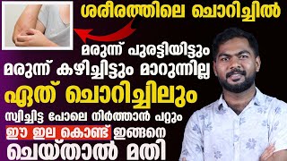 ചൊറിച്ചിൽ ഈസിയായി മാറ്റിയെടുക്കാനുള്ള സിമ്പിൾ ടിപ്സ് [upl. by Noiramaj]