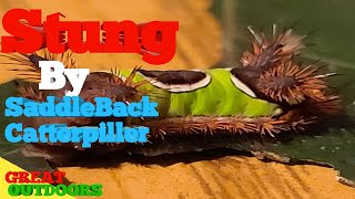 Stung By the SaddleBack Catterpiller [upl. by Atilahs]