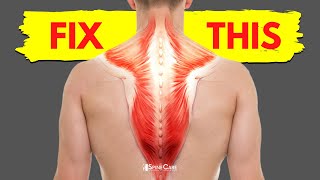 How to Fix a Tight Upper Back in 30 SECONDS [upl. by Annadroj101]