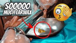 Soooo Much Ear Wax 👂🏻👀 EarWaxRemoval earwax [upl. by Nare]