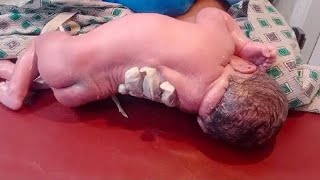 New born male baby came delivred with lscs baby is so energetic and cry in a strong way remov vernix [upl. by Kevon333]