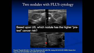 Thyroid Fine Needle Aspiration FNA and Cytology [upl. by Ateekal718]