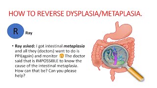 Metaplasia dysplasia How to reverse dysplasia metaplasia Natural treatment [upl. by Dwain]