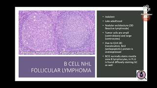 Lymphomas [upl. by Brandyn]