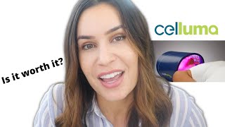 Celluma Pro Review and Update  Is Red Light Therapy WORTH IT [upl. by Nylsoj]