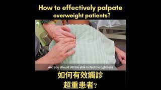 How to effectively palpate overweight patient [upl. by Aehsan252]