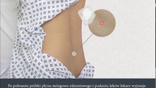 Lumbar Puncture Polish  Nakłucie lędźwiowe [upl. by Amerigo267]