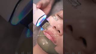 Lets recharge her face today immersiveskincare removeblackheads blackheads velvethair asmr [upl. by Hsreh279]