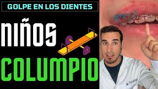 GOLPE en los DIENTES con BRACKETS  NIÑOS COLUMPIO 👄Smashmouth [upl. by Nnuahs]