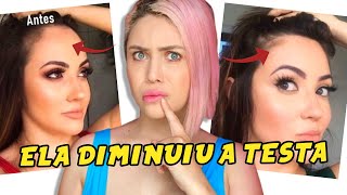 CIRURGIA PARA DIMINUIR A TESTA  ESSA YOUTUBER SÓ USAVA FRANJA E FEZ A FRONTOPLASTIA [upl. by Drusilla]