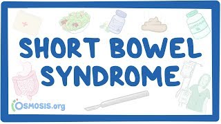 Short bowel syndrome  causes symptoms diagnosis treatment pathology [upl. by Aligna]