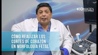 Cómo realizar los Cortes Ecográficos de Corazón en Morfología Fetal [upl. by Eisele]