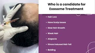 Exosome Treatment l Hair Loss l Balding l Hair Fall l Twacha l Dwarka l Delhi [upl. by Adnarrim]