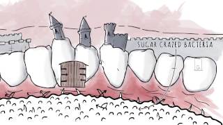 How Xylitol Works  Spry Dental Defense from Xlear [upl. by Nonnahc]