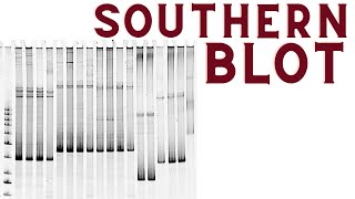 Southern blot  Southern blotting technique explained [upl. by Eelrihs]