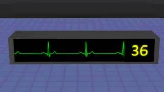 EKG for Second Life virtual reality world [upl. by Haliak758]