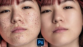 Face Retouching  Best Photoshop Tutorial  Skin Retouching 2023 [upl. by Enyak]