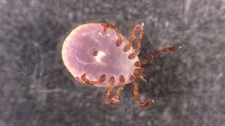 Tick identification 2023 [upl. by Crawford]