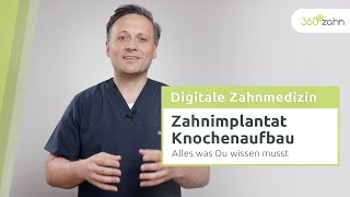 Zahnimplantat Knochenaufbau  Digitale Zahnmedizin  360°zahn [upl. by Les]