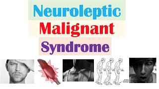 Neuroleptic Malignant Syndrome  Causes Pathophysiology Symptoms Diagnosis Treatment [upl. by Gunthar]