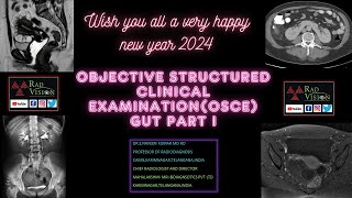 Objective structured clinical examination OSCE GUTI [upl. by Nwahsat458]