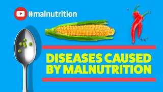 Diseases Caused by Malnutrition  SCURVY RICKETS BERIBERI PELLAGRA [upl. by Marrilee930]