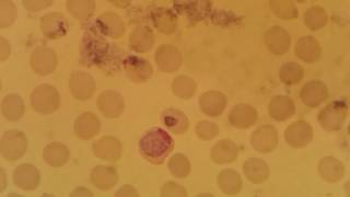 Plasmodium vivax gametocyte stage [upl. by Einallem]