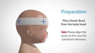 Using our Craniometer to Measure and Monitor Flat Head Syndrome [upl. by Enyamert250]