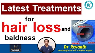 Latest treatments for hair loss and baldness  latesttreatments haircare [upl. by Wohlen]