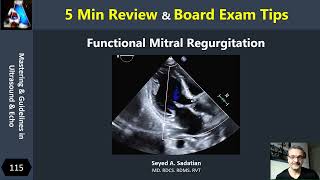 5 Min Review  Functional Mitral Regurgitation [upl. by Supmart548]