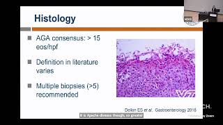 Eosinophilic Esophagitis EoE Lessons Learned from Medicaid and the UVA EoE Cohort [upl. by Ellerihs]