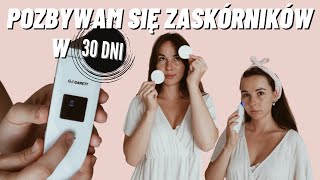 ❤️ PEELING KAWITACYJNY W DOMU CZY WARTO MOJE EFEKTY [upl. by Syck]