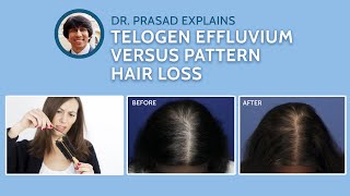 Differences Between Telogen Effluvium and Genetic Pattern Hair Loss [upl. by Letnuahc]