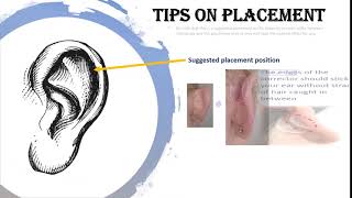 Otostick Ear Corrector  Placement Tips [upl. by Aicemed634]