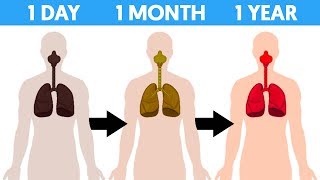 Dizzy After Quitting [upl. by Purse]