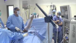 Shoulder Arthroscopy Surgery [upl. by Macintosh]