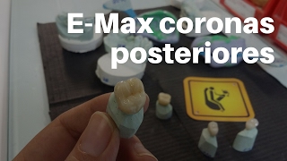 ✅ PASOS para CementaciónAdhesión Coronas EMax Posteriores👅CoronasDentales CoronasTotalPorcelana [upl. by Eerehc740]