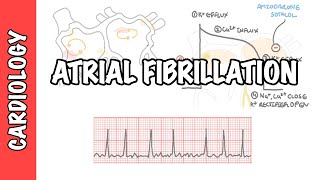 Atrial Fibrillation Overview  ECG types pathophysiology treatment complications [upl. by Atnovart209]