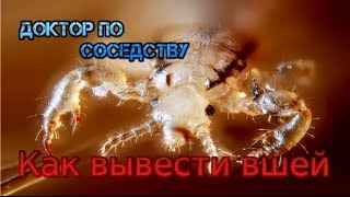 Как вывести вшей  How to remove lice [upl. by Talanian]