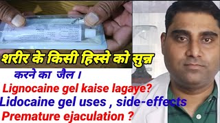 Topical anesthesia  सुन्न करने की दवा Lignocaine Hydrochloride Gel iplidocaine 2 jelly uses [upl. by Hplodur]